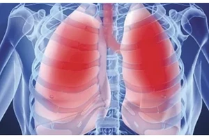 Lời khuyên cho người đang bỏ hút thuốc lá và cách tăng cường sức khỏe phổi