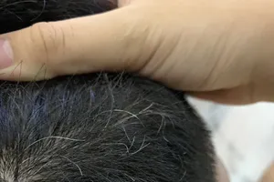 Giảm tình trạng tóc bạc sớm với 5 siêu thực phẩm này