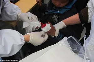 Giận chồng, vợ chặt phăng 3 ngón tay con trai 8 tuổi