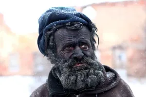 Kỳ lạ: người đàn ông bẩn nhất châu Âu và...đống tro nóng