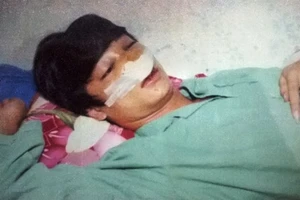 Học sinh lớp 11 tố bị CSGT đánh vỡ xương mũi