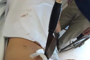Bị chém nhầm, nam thanh niên nhập viện với con dao đâm xuyên mông