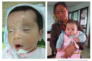 Chú ý: Trẻ sơ sinh bú kém, li bì và hôn mê không rõ nguyên nhân 