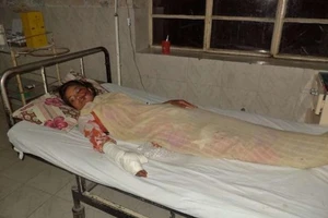 Cô gái bị gia đình hành quyết vì lấy người yêu