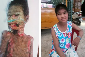 Trở về từ cõi chết