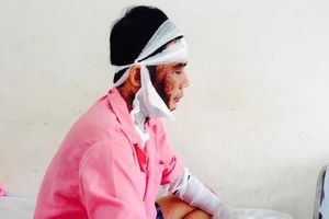 Một quản lý công ty nước ngoài bị tạt a-xít dã man