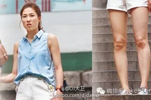 Mỹ nữ TVB với cặp đầu gối kỳ dị