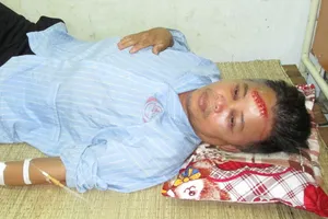 “Cẩu tặc” hung tợn dùng kiếm chém công an vỡ xương sọ não