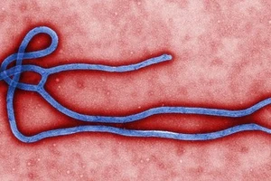 Mọi điều cần biết về Ebola - Đại dịch đang đe dọa thế giới