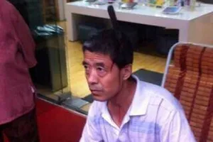 Người đàn ông bị con dao "từ trên trời rơi xuống" cắm thẳng vào đầu