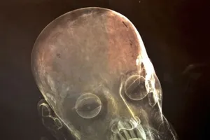 Lạ: Phát hiện răng người thật "mọc" trong miệng tượng Chúa Giêsu 300 tuổi