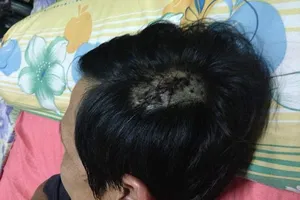 Bắt nhóm côn đồ xông vào nhà hành hung người dã man