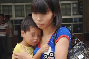 Sốc: Bé gái 29 tháng tuổi bị bạo hành gãy 4 răng cửa