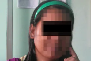 Thương tâm: Cô dâu Việt phát điên vì đi làm dâu xứ người