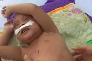 Sốc: Bé trai hai tuổi bị... bà ngoại bạo hành phải nhập viện