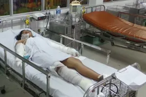 Nhiều nhà hảo tâm giúp đỡ bé gái bán vé số bị mẹ đốt