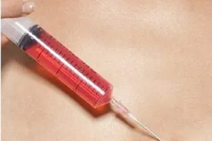 Sẽ áp giải nữ giám đốc thuê người truyền HIV đến tòa