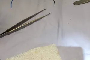 Để không có những tai nạn đau lòng khi trẻ chơi đùa