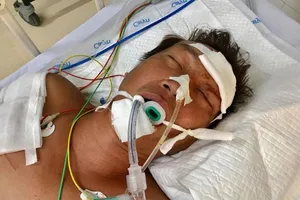 Tim người thân cho bệnh nhân bị tai nạn giao thông