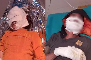 Điện thoại phát nổ khiến 2 vợ chồng bỏng nặng