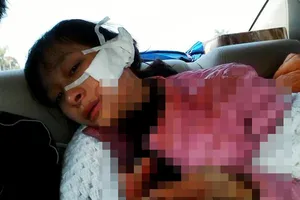 Khởi tố vụ án nữ sinh lớp 11 bị rạch mặt 