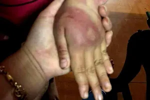 Bố đánh con gái 8 tuổi dã man rồi bỏ trốn