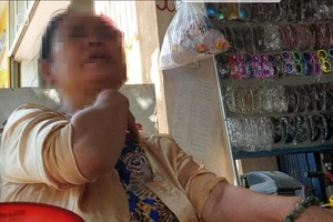 Tài xế của lãnh đạo công an Thanh Hóa bị 1 thanh niên tấn công