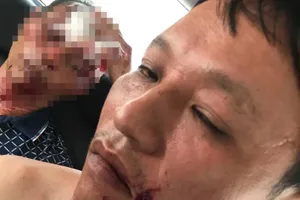 Băng côn đồ xả súng vào một gia đình sau bữa cơm trưa