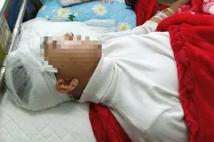 Nam sinh Phan Thanh L. lớp 11A6, Trường THPT Lang Chánh bị bạn cùng trường đánh vỡ sọ não. Ảnh: ĐT