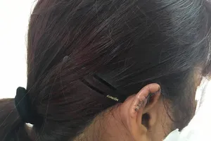 Phụ huynh nói gì khi bị tố cắn đứt tai cô giáo?