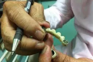 Sặc nước, trôi nguyên hàm răng giả vào cổ họng