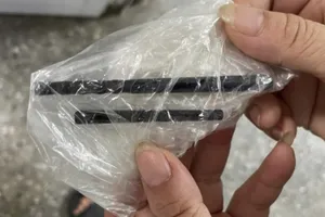 Người đàn ông bị đũa đâm xuyên từ mũi lên não nhưng không hay biết