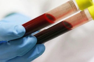 Trong kỳ kinh, xét nghiệm máu chính xác không?