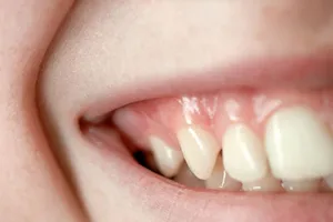 Nhìn răng miệng, chẩn bệnh