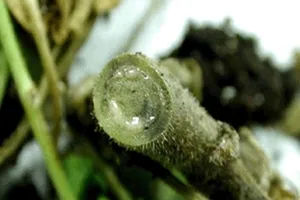 Thấu trời những tai nạn khó tin với ‘cậu bé’