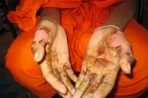 Bị bắt nhúng tay vào nước sôi để chứng minh 'không ăn cắp'