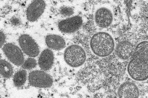 WHO kêu gọi công chúng tham vấn đổi tên bệnh đậu mùa khỉ 