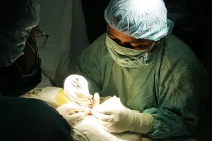 Mất khả năng cầm và nắm do bỏ trị liệu