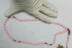 Chuỗi hạt dài 80cm trong thực quản cụ ông