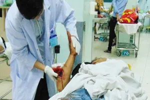 Gãy tay gãy chân chỉ vì... áo khoác không cài dây khóa