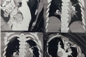 Bỗng dưng mất ý thức đột ngột, hãy đến bệnh viện ngay 