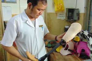 Một BV nhận làm chân giả cho bé bị cắt chân oan uổng 