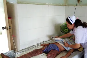 Bị đoạn chi vì bạn táy máy tay chân