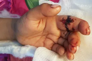 Đúng là 'chơi dao có ngày đứt tay'!