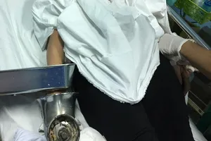 Mất nguyên bàn tay vì chiếc máy xay thịt