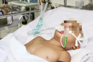 Trượt cầu thang ướt mẹ vừa lau, con bị thương nặng