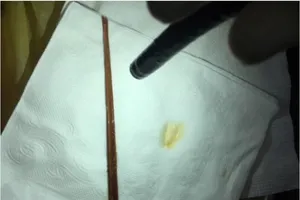 Nhậu 1 mình buồn quá, lấy nhang đang cháy làm… mồi nhậu