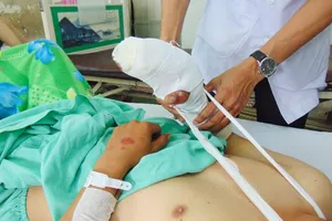 Thêm trường hợp nát bàn tay do pháo tự chế