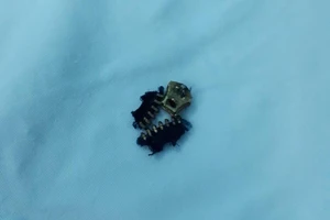 Giải cứu 'của quý' bị mắc kẹt vô khóa quần