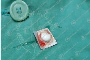 Ho ra máu vì uống nhầm viên thuốc chưa bóc vỏ